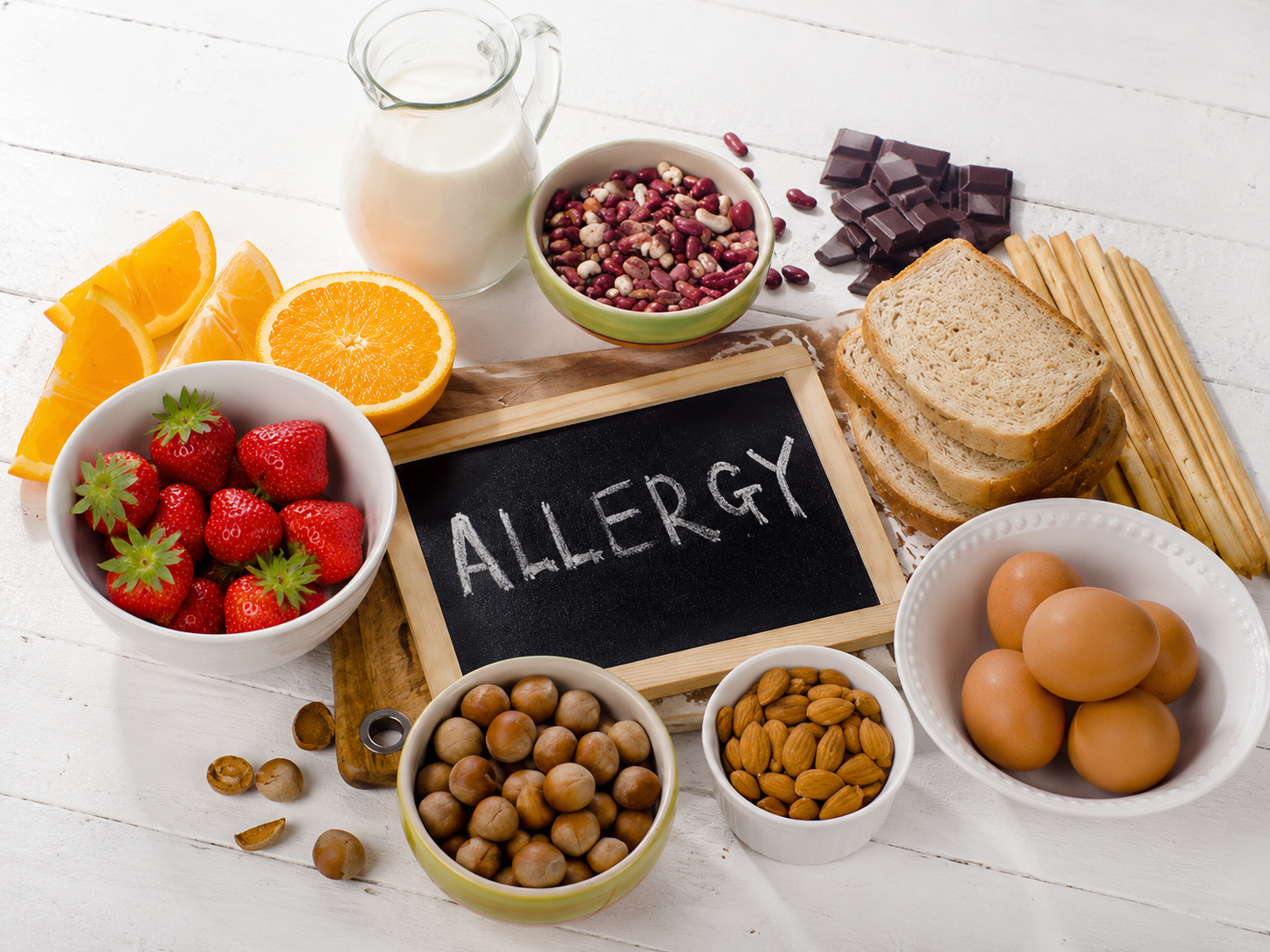 Food Allergies Testing In Eagle Mountain