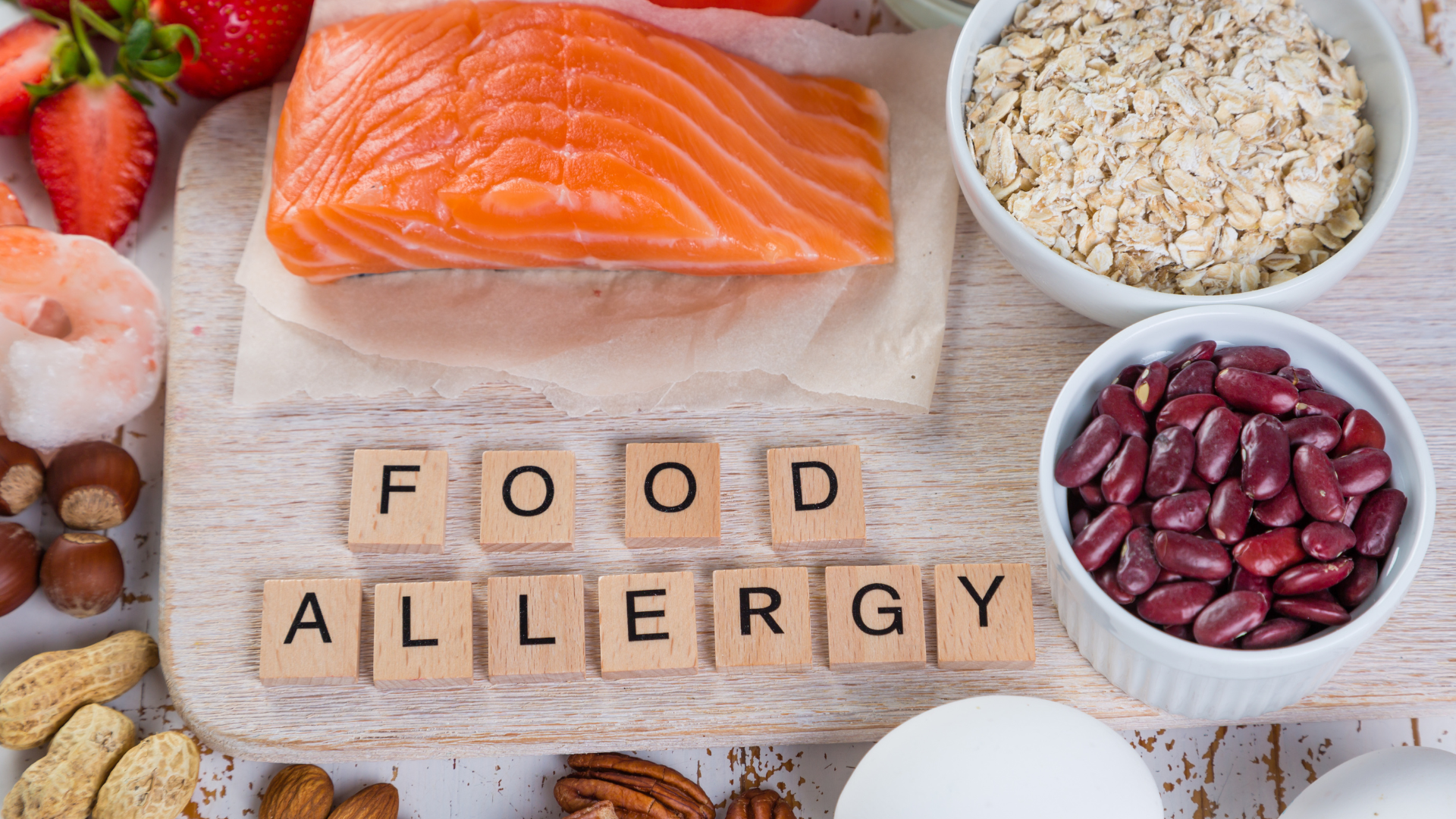 Food Allergy Testing - BEagle Mountain Utah, Cedar Valley Health