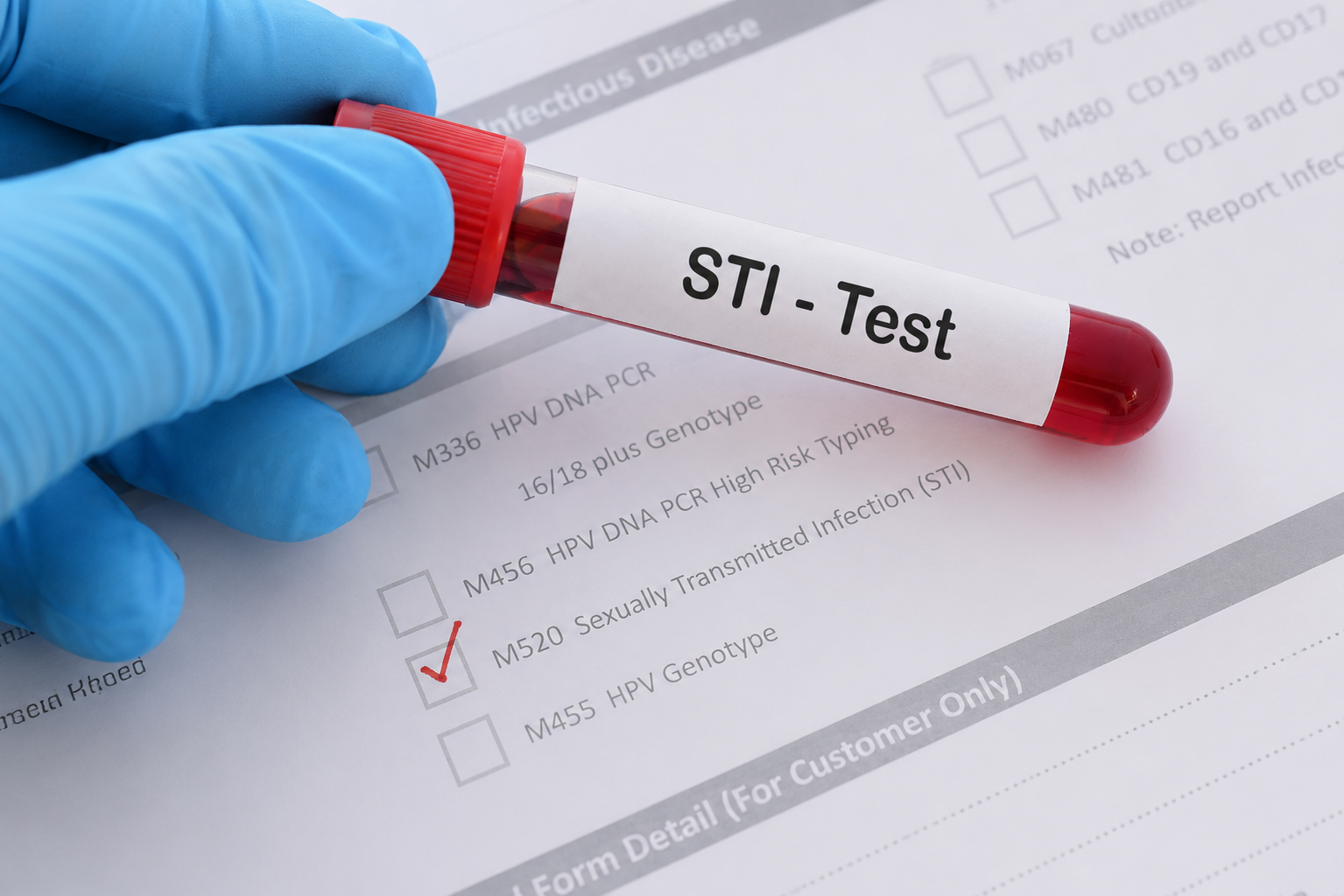STD Testing & STI Testing in Eagle Mountain