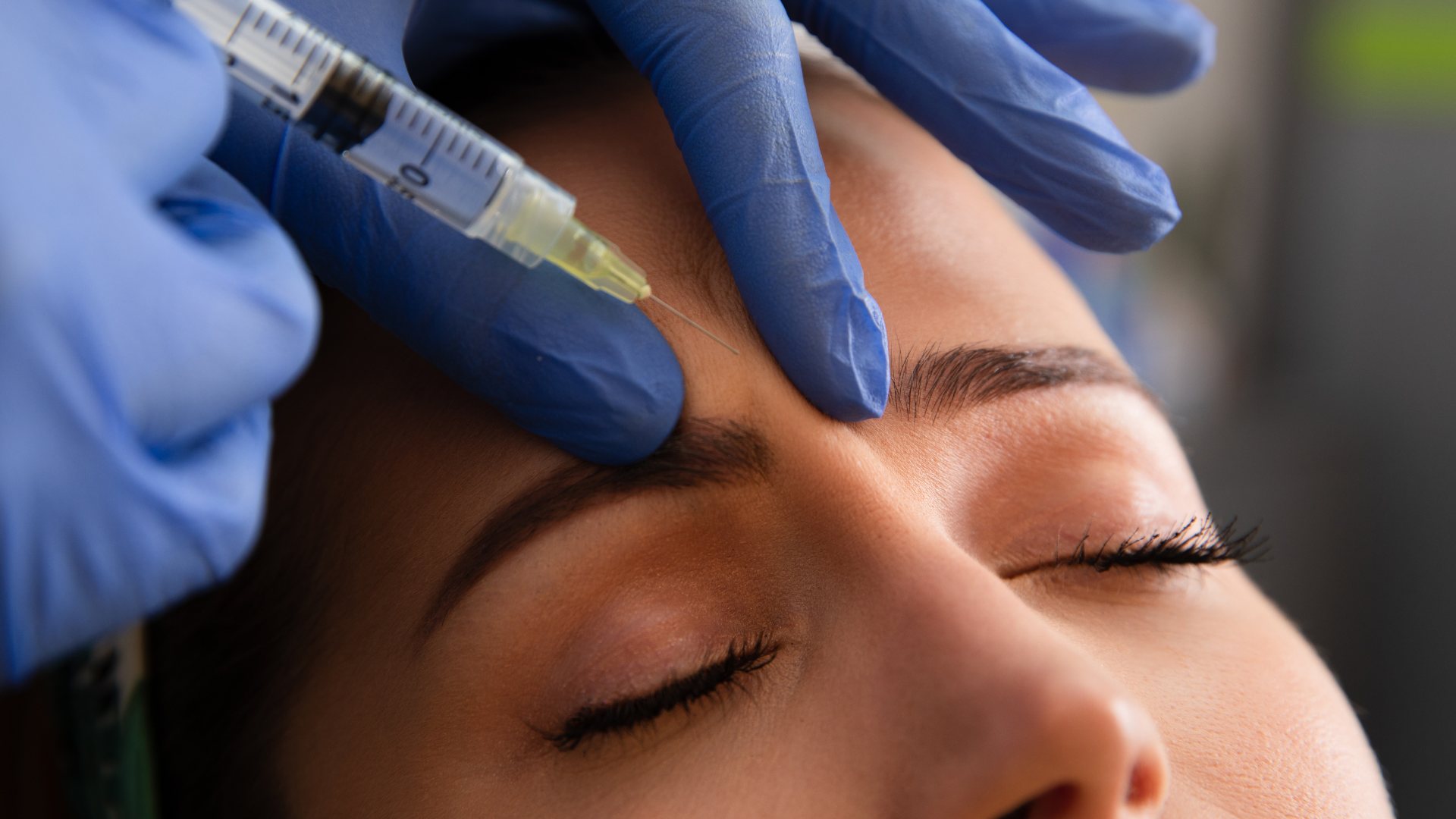 Botox & PDO Threads in Eagle Mountain, UT | Cedar Valley